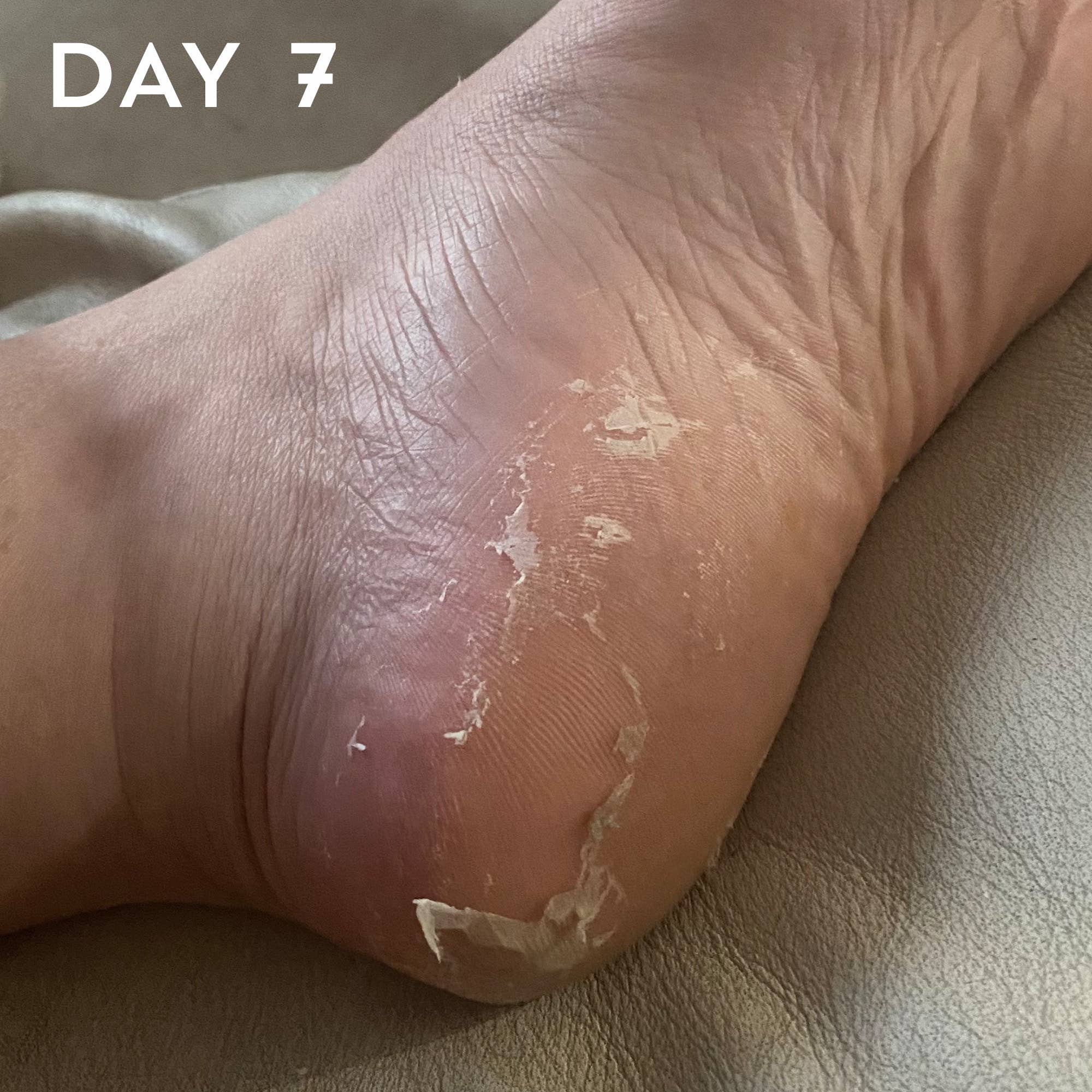 +maskology +serumology - Wholesale Foot Mask - +maskology FOOT PEEL Professional Foot Treatment7