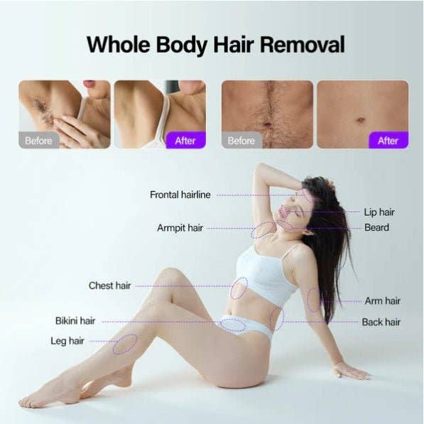 Cavitation Machines - Wholesale Electronic Skincare Device - Shape Tactics Soprano Ice Pro 4-in-1 Laser Hair & Skin System6