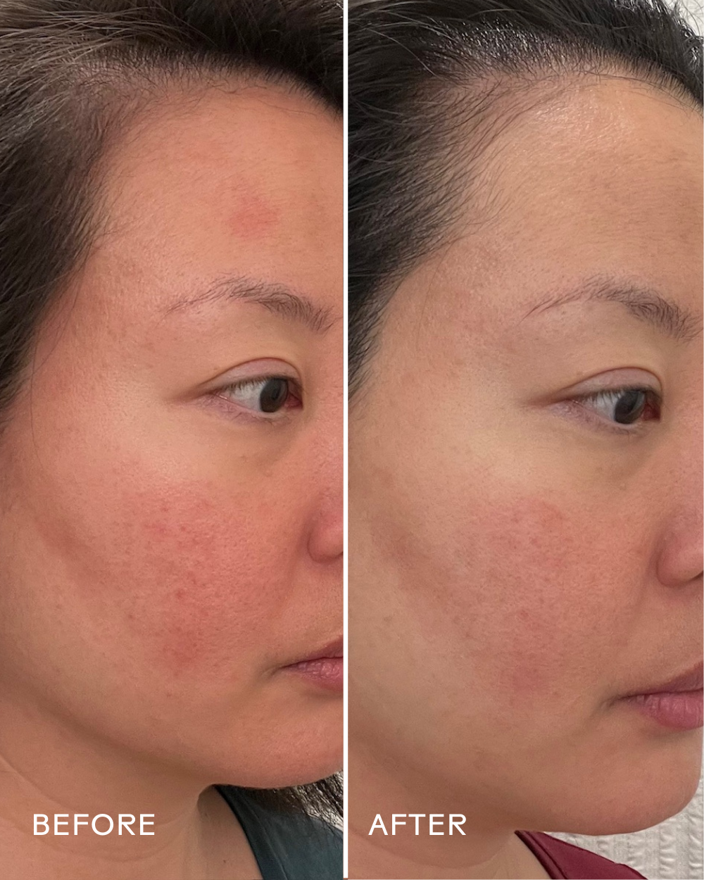 Three Ships (No Duties | Ships from US/CA | USMCA Compliant) - Wholesale Facial Serum/Concentrate - Replenish Ceramides + Blueberry Barrier Repair Serum4