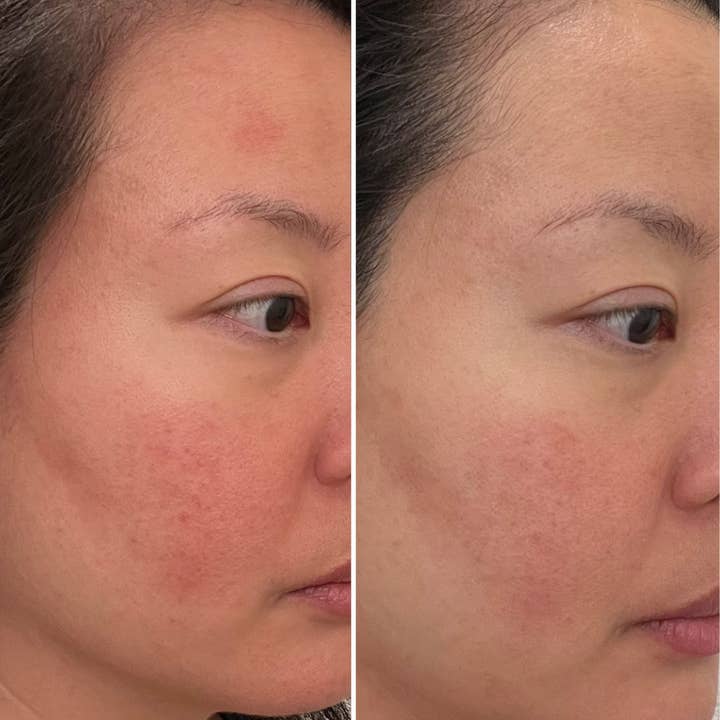 Three Ships (No Duties | Ships from US/CA | USMCA Compliant) - Wholesale Facial Serum/Concentrate - Replenish Ceramides + Blueberry Barrier Repair Serum4