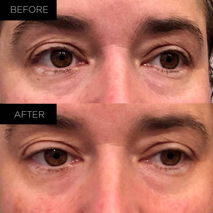 Endure Beauty - Wholesale Eye Treatment Mask - Endure Under Eye Therapy Gel Pads - Renewing4