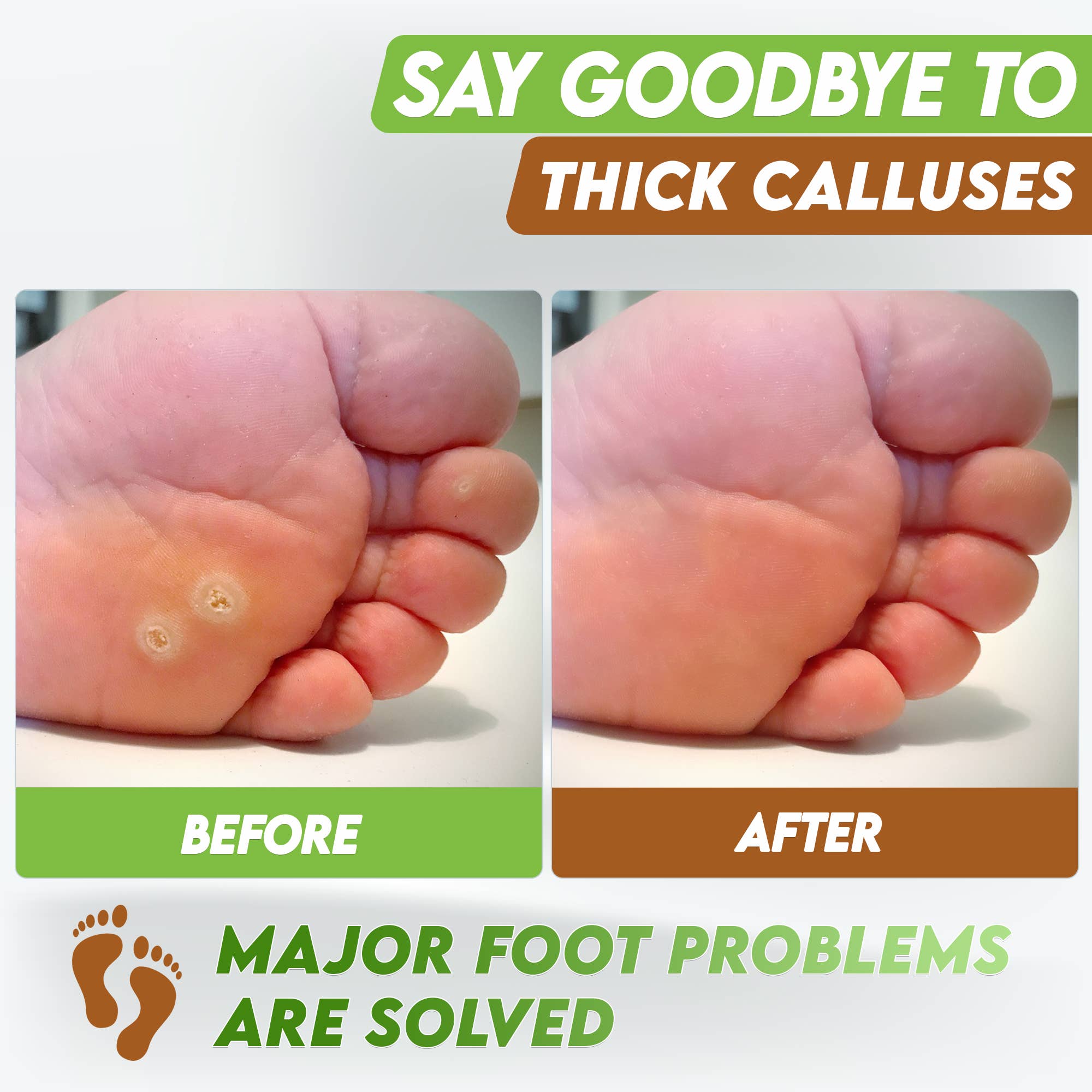 Karma Organic spa - Wholesale Foot Mask - Foot Peel Mask 2 Pack –Coconut Peeling Mask 100% Organic6