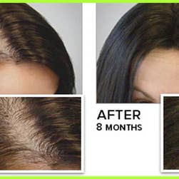 The Hair Fuel - Wholesale Silk/Microfiber Haircare - Dermastamp4