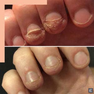 Naturally My Sister’s Keeper - Wholesale Foot Cream - Advanced Fungal Treatment for Feet and Nails13