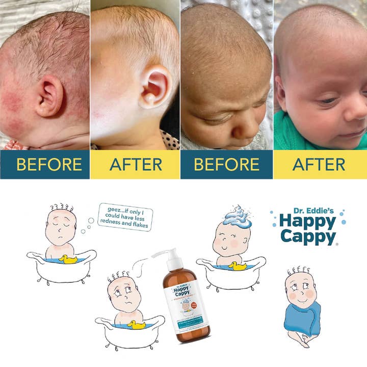 Happy Cappy - Wholesale 2-in-1 Shampoo & Body Wash - Baby - Happy Cappy Dr. Eddie’s Medicated Shampoo 8 oz pump bottle2