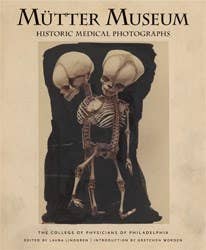 Microcosm Publishing & Distribution - Wholesale Medical Health Book - Mutter Museum: Historic Medical Photographs0