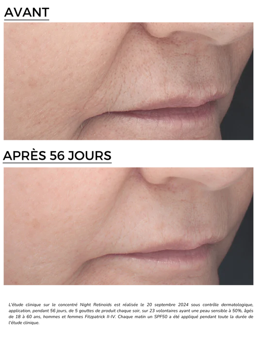 DERMEDEN – Engroshandel Ansigtsserum – Night Retinoid Concentrate 6% - intensiv anti-age behandling2