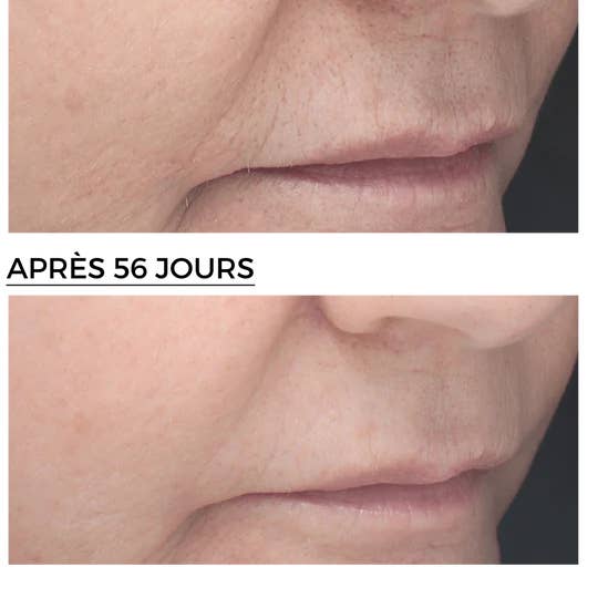 DERMEDEN - Wholesale Facial serum/concentrate - Night Retinoid Concentrate 6%2