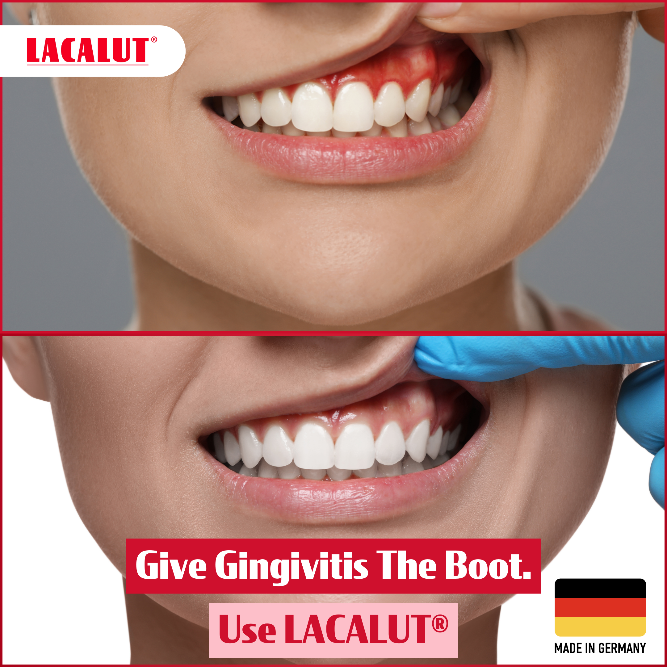 LACALUT - WHOLESALE - Wholesale Toothpaste - 40 x LACALUT® Aktiv 10ml Travel Size - RRP $2.0011