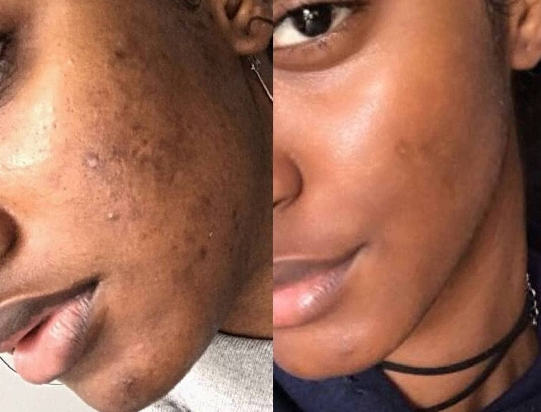 bconsciousnaturals - Wholesale Bar Soap - Plant Based Kojic Acid Skin Brightening & Clearing Blend Soap For Darkspots, Underarm Lightening, Anal Lightening,Yoni Lightening,Back Scars2