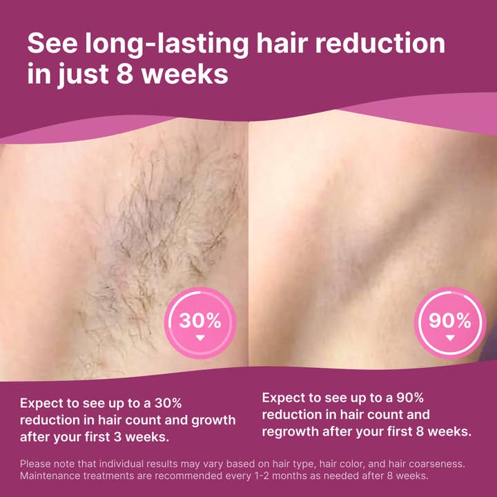 Happy Nuts - Wholesale Body Hair Removal Product - Happy Curves Beam At-Home IPL Hair Removal System