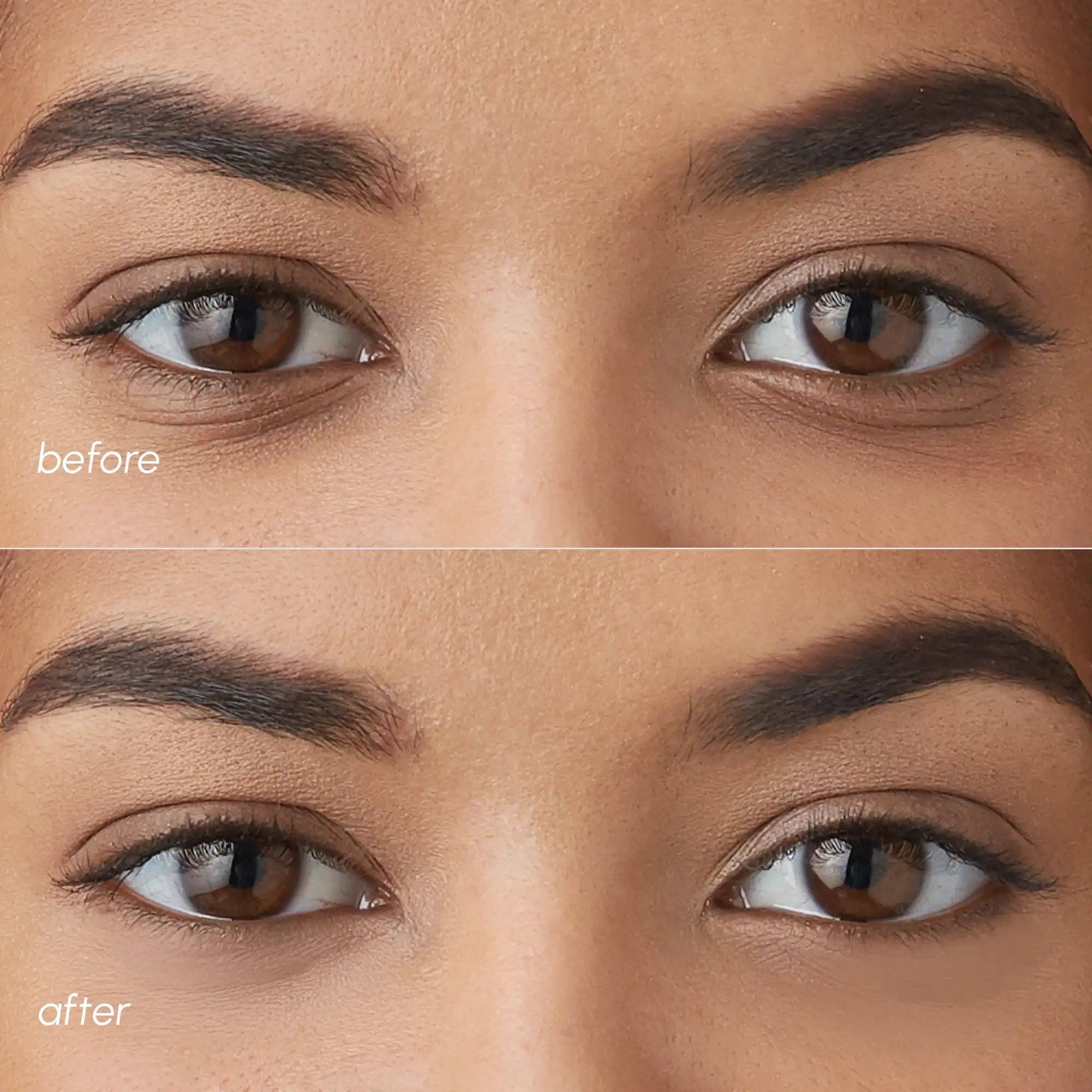 VIAI Beauty - Wholesale Eye Treatment Mask - MAREE Violet Eye Patches for Dark Circles5