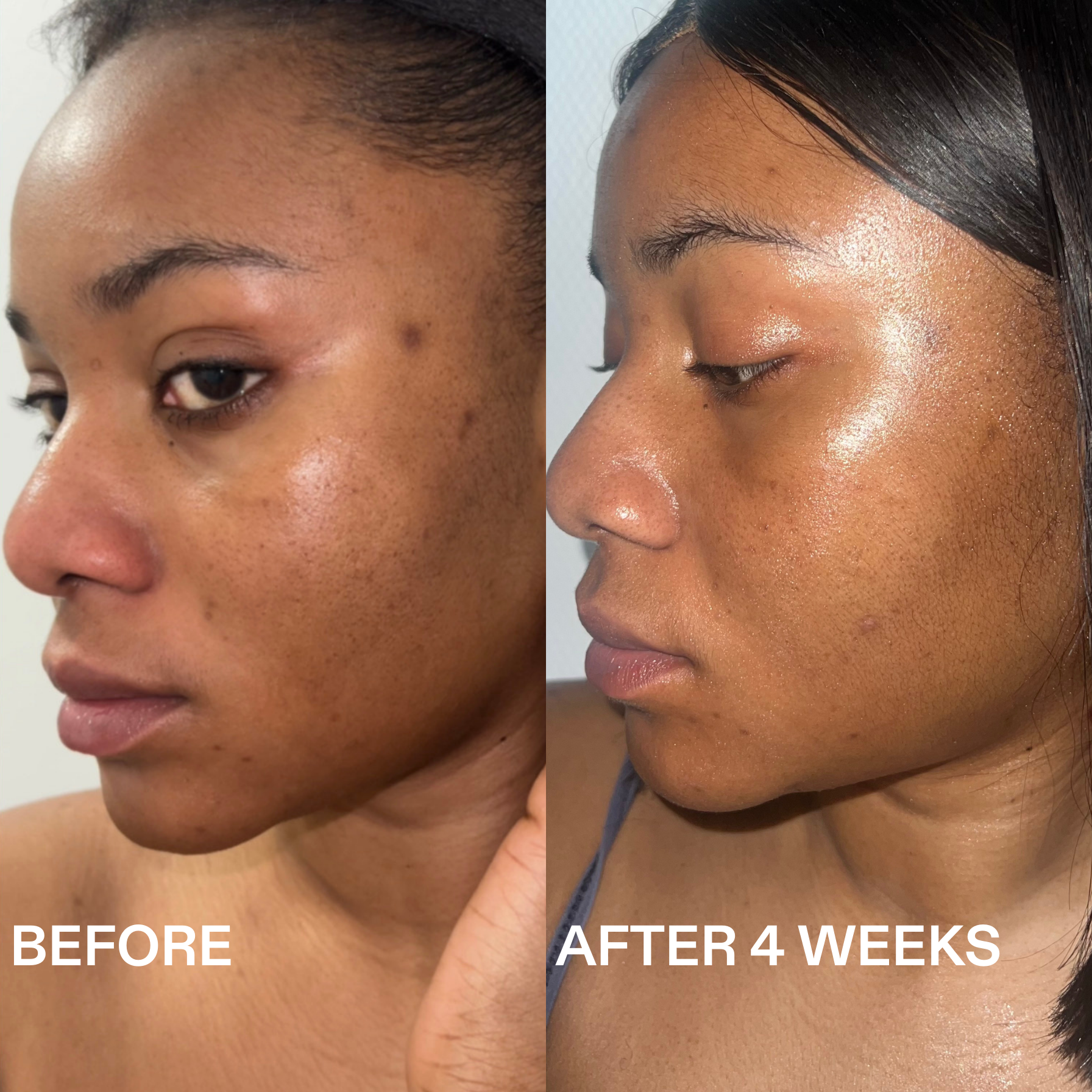 Routinely - Wholesale Facial Serum/Concentrate - TONE-EVENING TRANEXAMIC ACID SERUM1