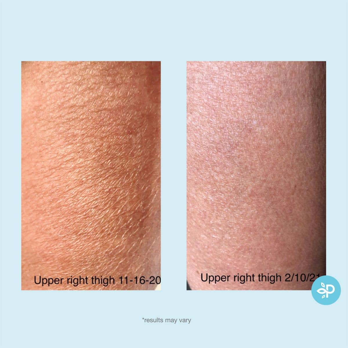 Perfect Image - Wholesale Body Cream/Lotion - Gly + Sal Exfoliating Body Lotion4