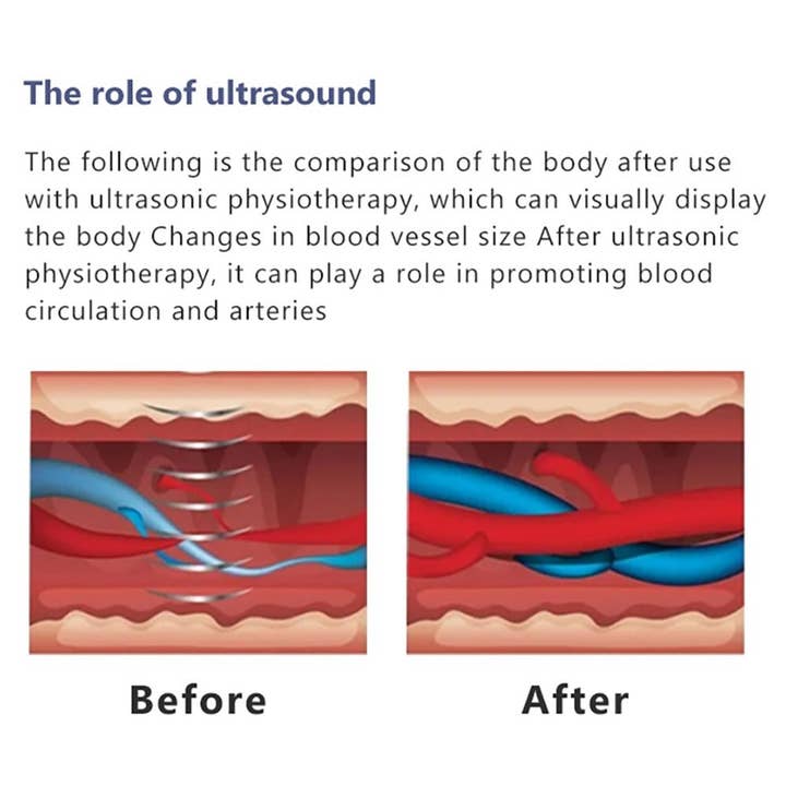 Cavitation Machines - Wholesale Electronic Skincare Device - Shape Tactics 2-in-1 Standing Shockwave & Ultrasound Therapy System12