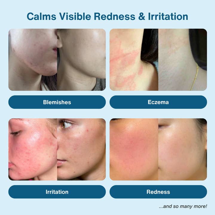 VC LEMONADE CORP. - Vendita all'ingrosso Spray/Acqua viso e corpo - Spray di Acido Ipocloroso 0,015% per Viso e Corpo3