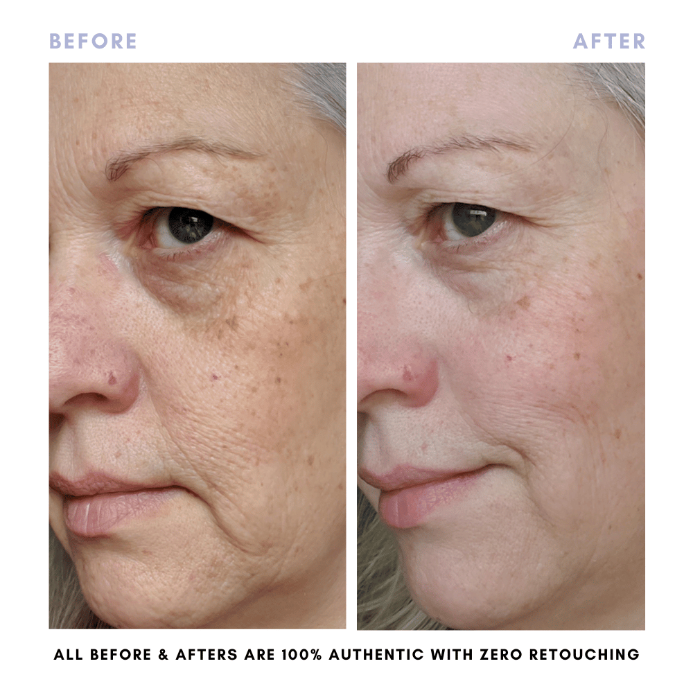 Clover By Clove + Hallow – Großhandel Gesichtspflege-Set – Das Juicy Skin Set6