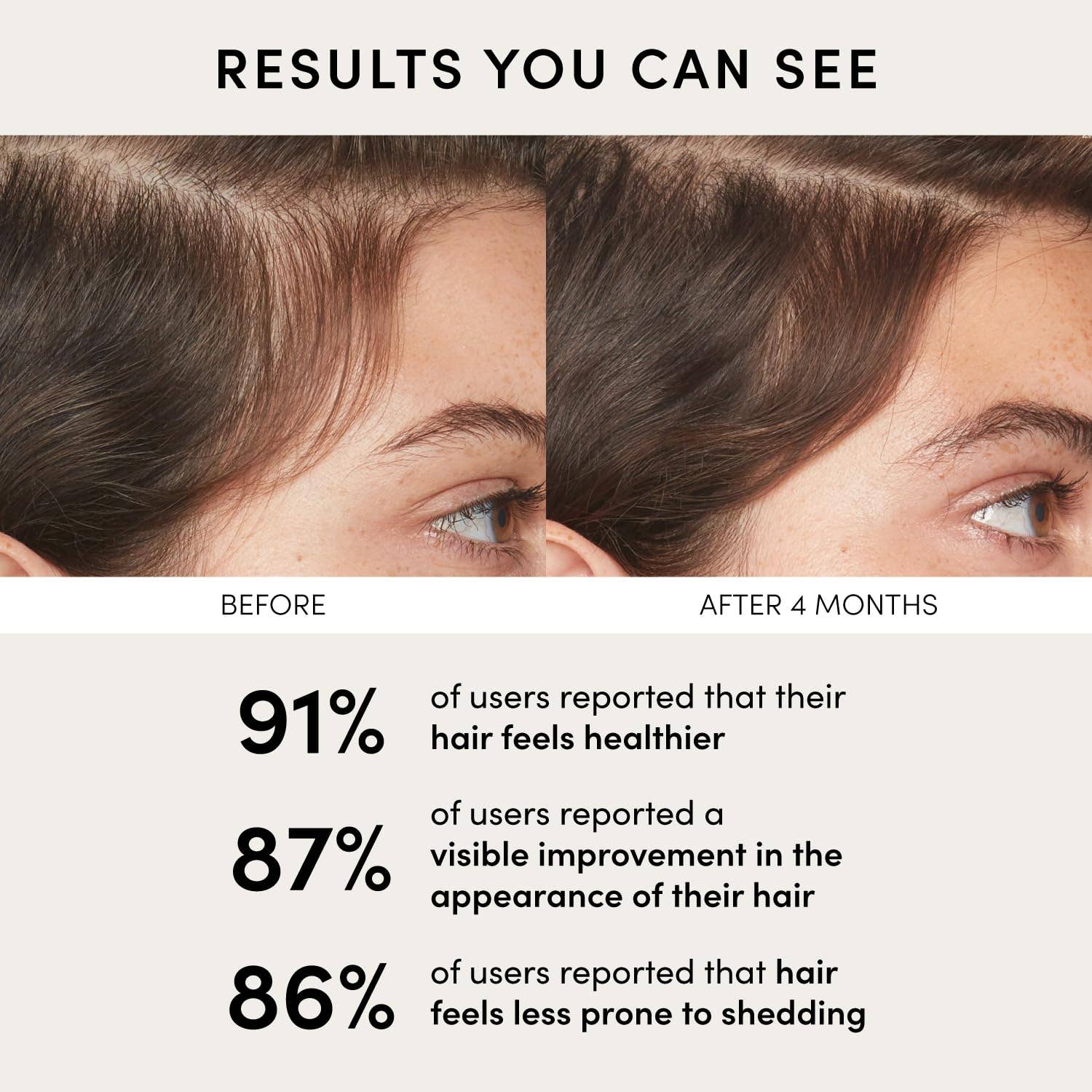 MEHIAZ – Tratamento de couro cabeludo/cabelo por atacado – Sérum para Couro Cabeludo OUAI - Sérum Capilar Equilibrante com Extrato de Trevo Vermelho4