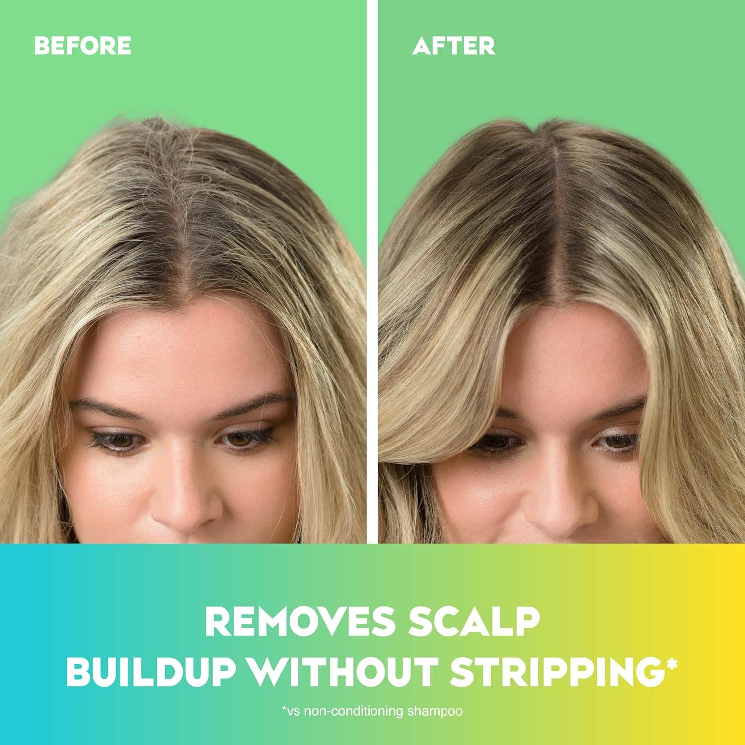 First Choice Buying – wholesale Hårschampo – OGX Extra Strength Uppfriskande Hårbotten + Schampo, Teatree Mint, 385 ml1