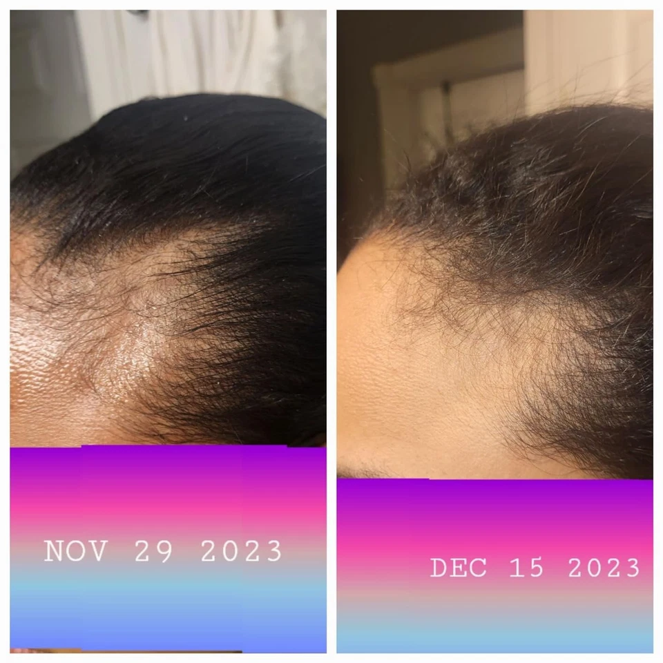 Au Natural Organics – wholesale Hair oil – Bulk Pure Batana Oil for Hair Growth Supplier Honduras 1 ltr6