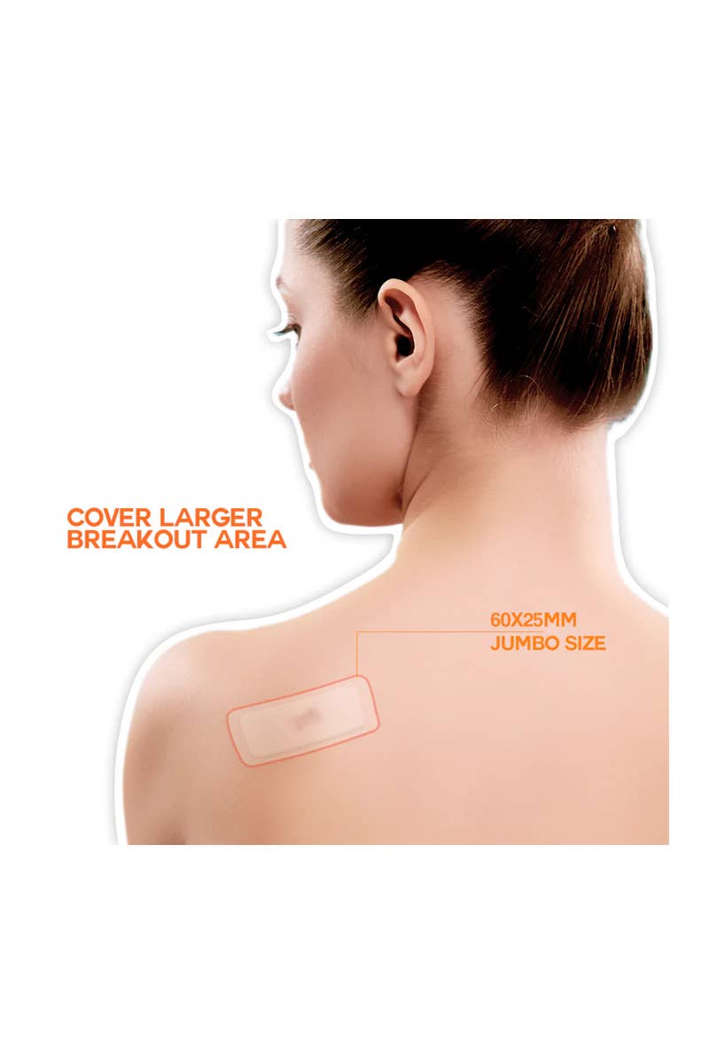 PINEAPPLE Beauty - Wholesale Acne/Hydrocolloid Patch - Epielle 0646-144 Acne Clear XL Patch - 12pc11