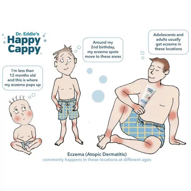 Happy Cappy - Wholesale Bath & Body Set - Baby - 3 Step Baby Skincare Routine Bundle to Manage Cradle Cap and Eczema (FREE Beanie Brush)19