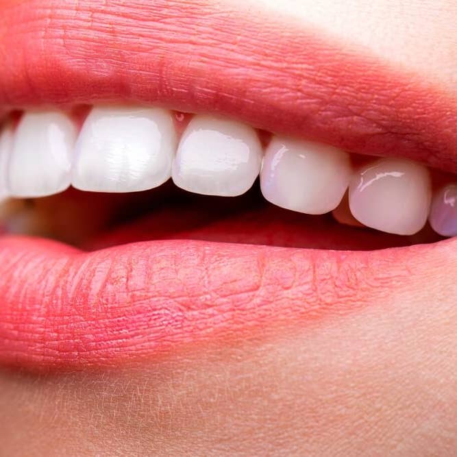 LaserGlowSpa – Branqueador de dentes por atacado – LaserGlow Brilho Dentário - Brilho Instantâneo e Sorriso Mais Branco