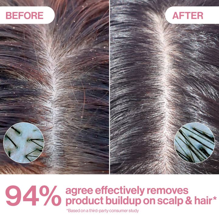 Rizos Curls - Wholesale Scalp/Hair Treatment - Apple Cider Vinegar Scalp & Hair Rinse2