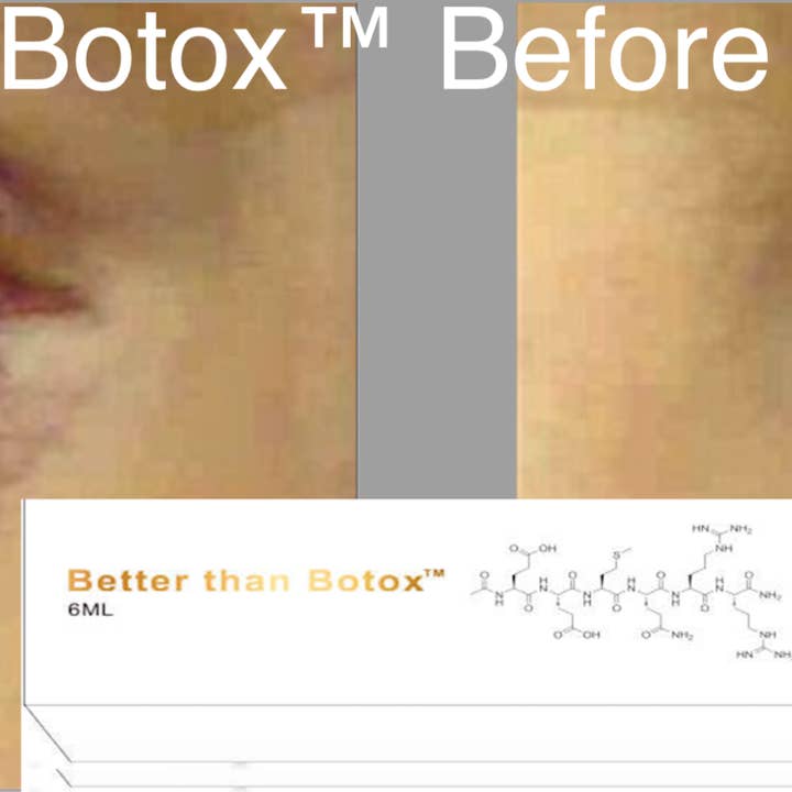 NABulous - Wholesale Facial serum/concentrate - Quantum Facial "Professional Edition"Better than Botox™ Under Eye Wrinkles4
