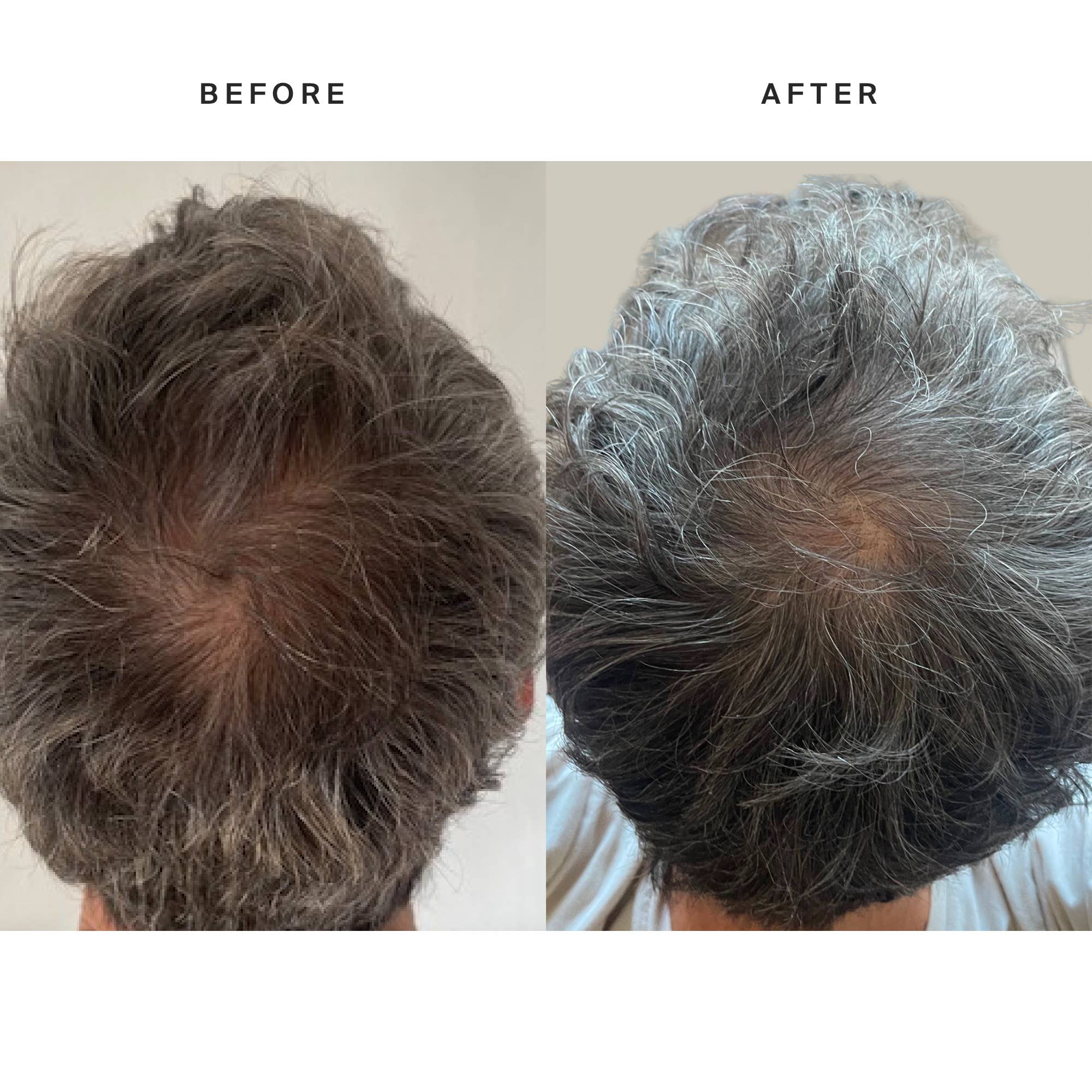 HigherDOSE - Vente Casquette de baseball – unisexe - Chapeau à lumière rouge HigherDose9