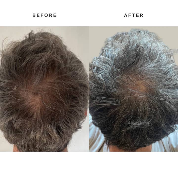 HigherDOSE - Wholesale Baseball Cap - Unisex - HigherDose Red Light Hat9