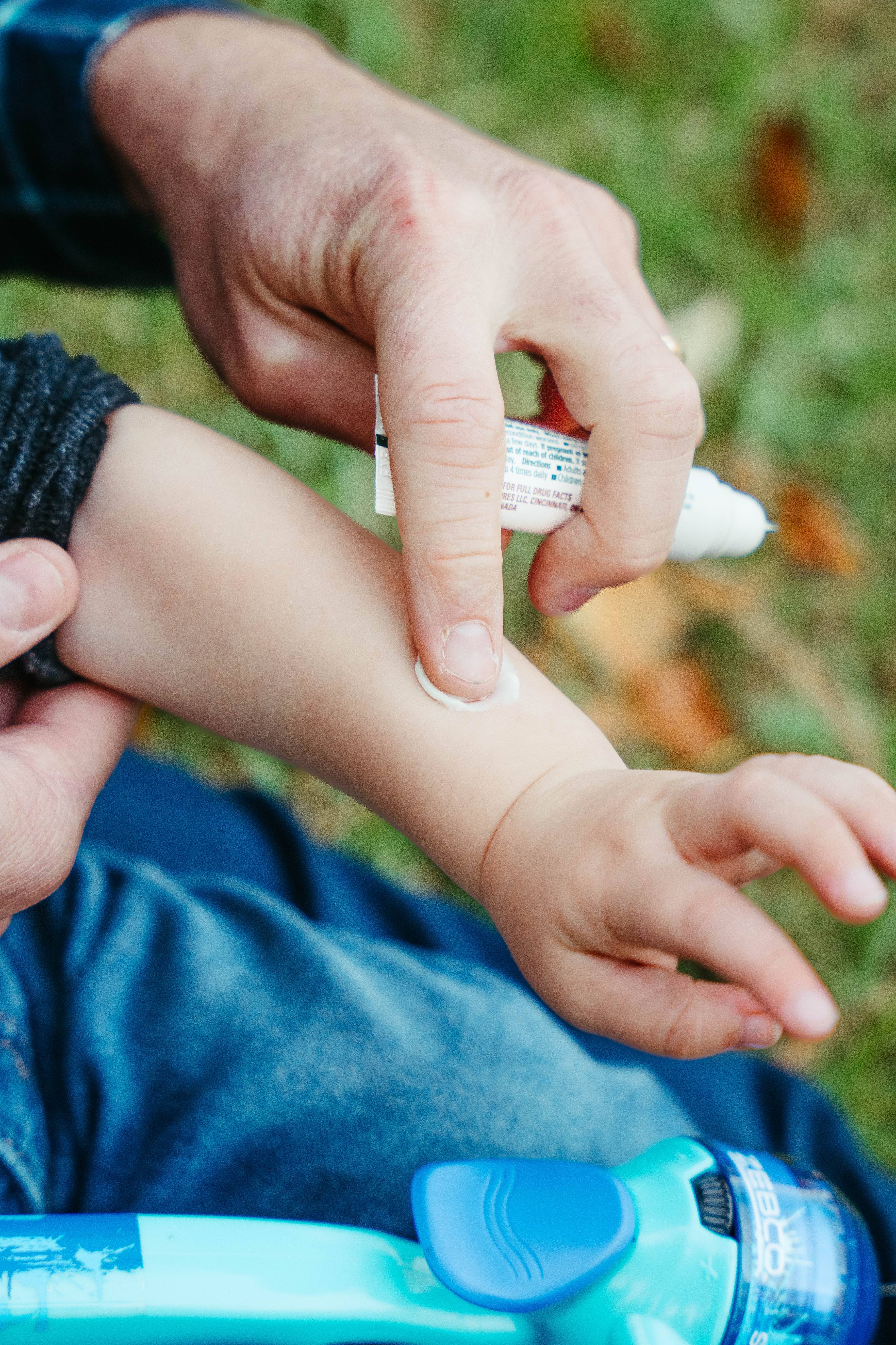 Nature's Willow - Wholesale Itch Ointment/Cream - Essential Oil Itch Relief Cream - 24 count hanging clipstrip5