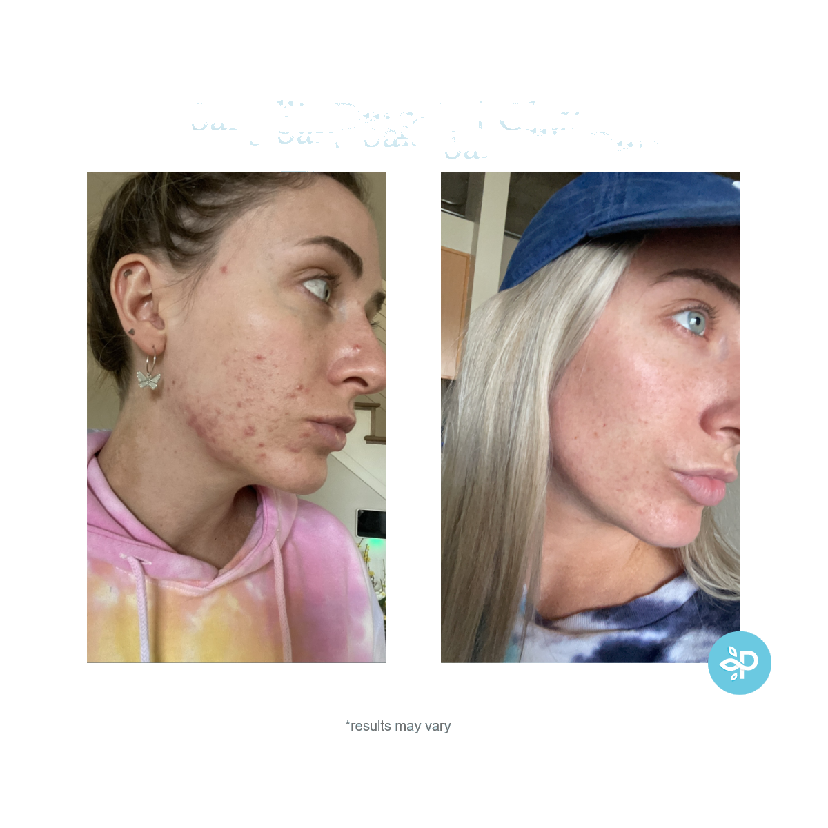 Perfect Image – Engroshandel Ansigtsrens – Salicylsyre dybderensende gel7