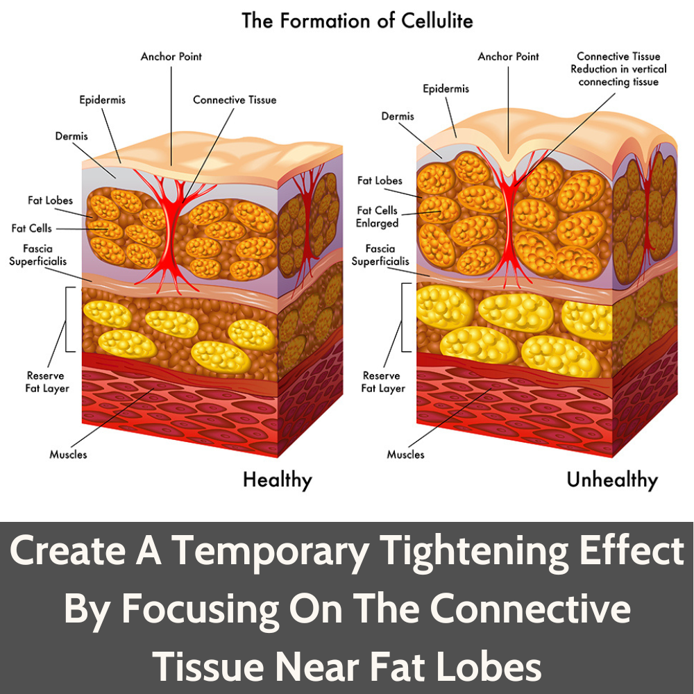 Rollga - Wholesale Skin Smoothing Kit - Rollga OCTO - Cellulite Reduction Fascial Release Tool2