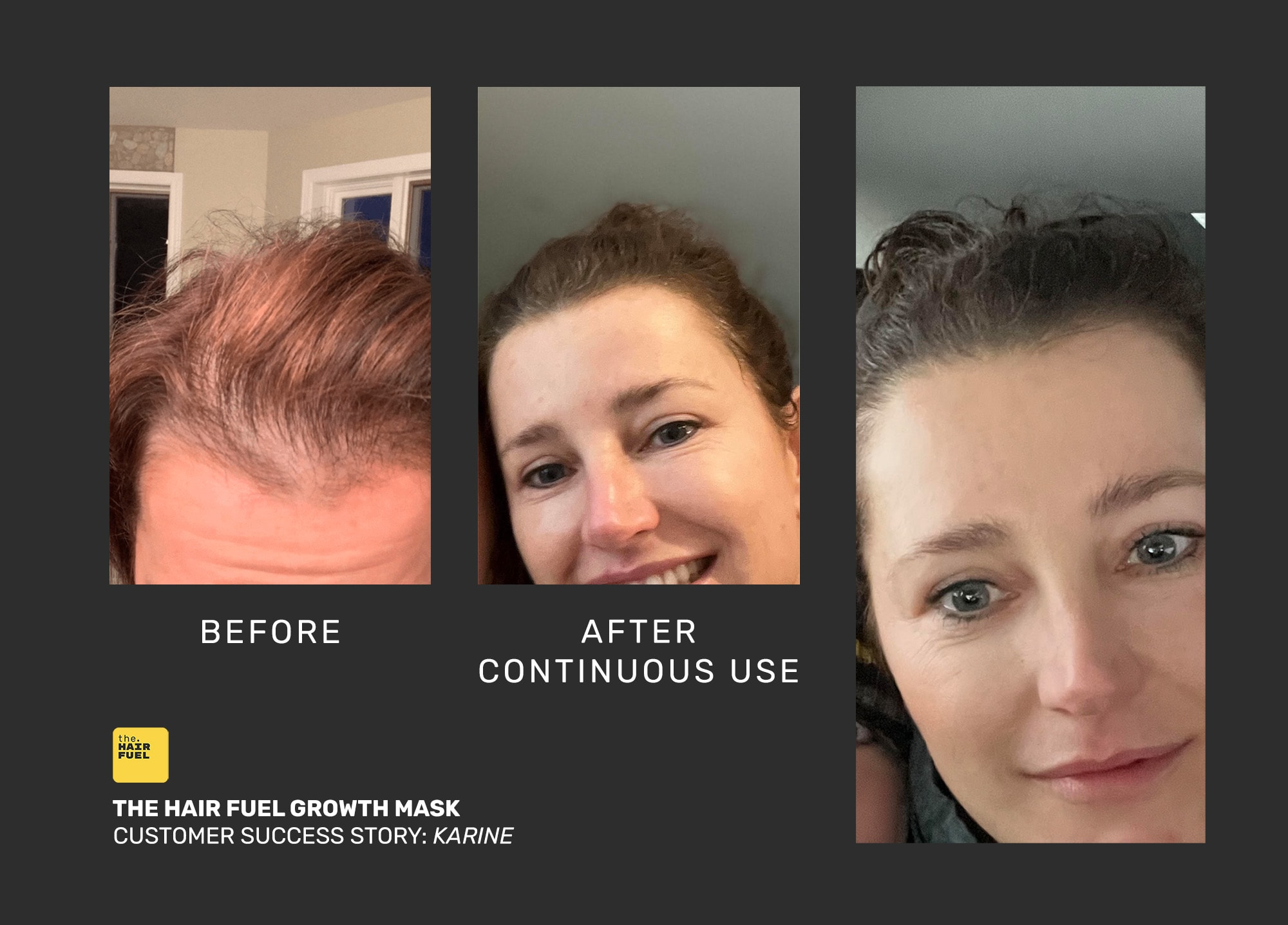 The Hair Fuel – Máscara capilar por atacado – Máscara de Tratamento para Crescimento Capilar – Natural & Vegan23