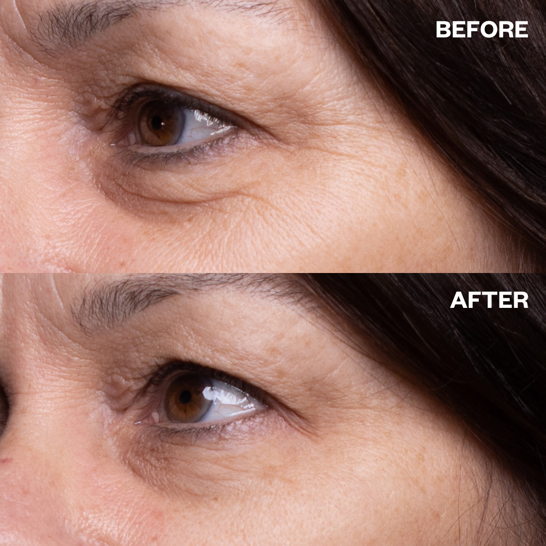 Wrinkles Schminkles - Vendita all'ingrosso Maschere trattamento occhi - Patch anti-rughe per contorno occhi3