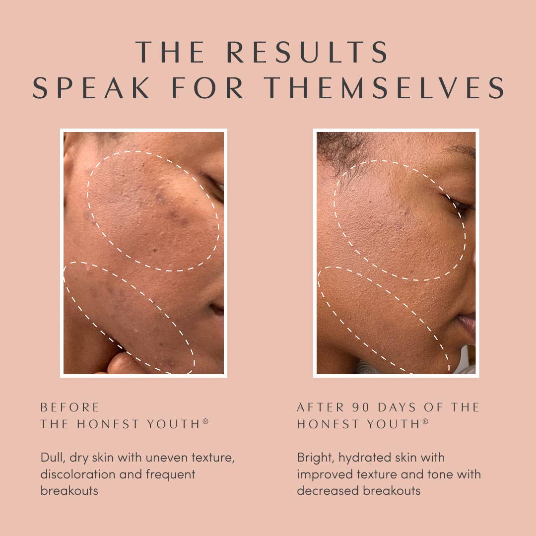 Apothékary - Wholesale Oral Supplement/Vitamin - The Honest Youth™ for skin & anti-aging collagen drops4