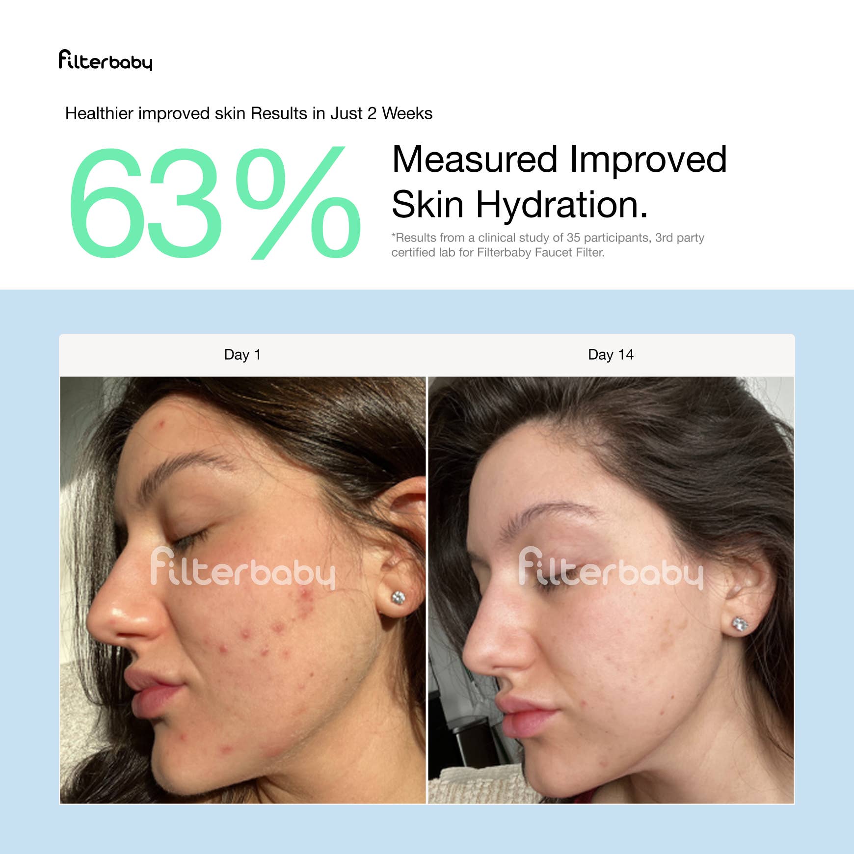 Filterbaby - Wholesale Shower Head - Filterbaby Diamond Series Shower Filter - Gold (By Case)7