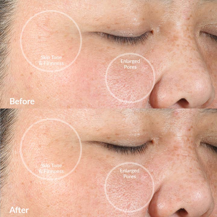 PMD Beauty - US - Wholesale Electronic Skincare Device - PMD Clean SonicGlow Facial Cleansing Device