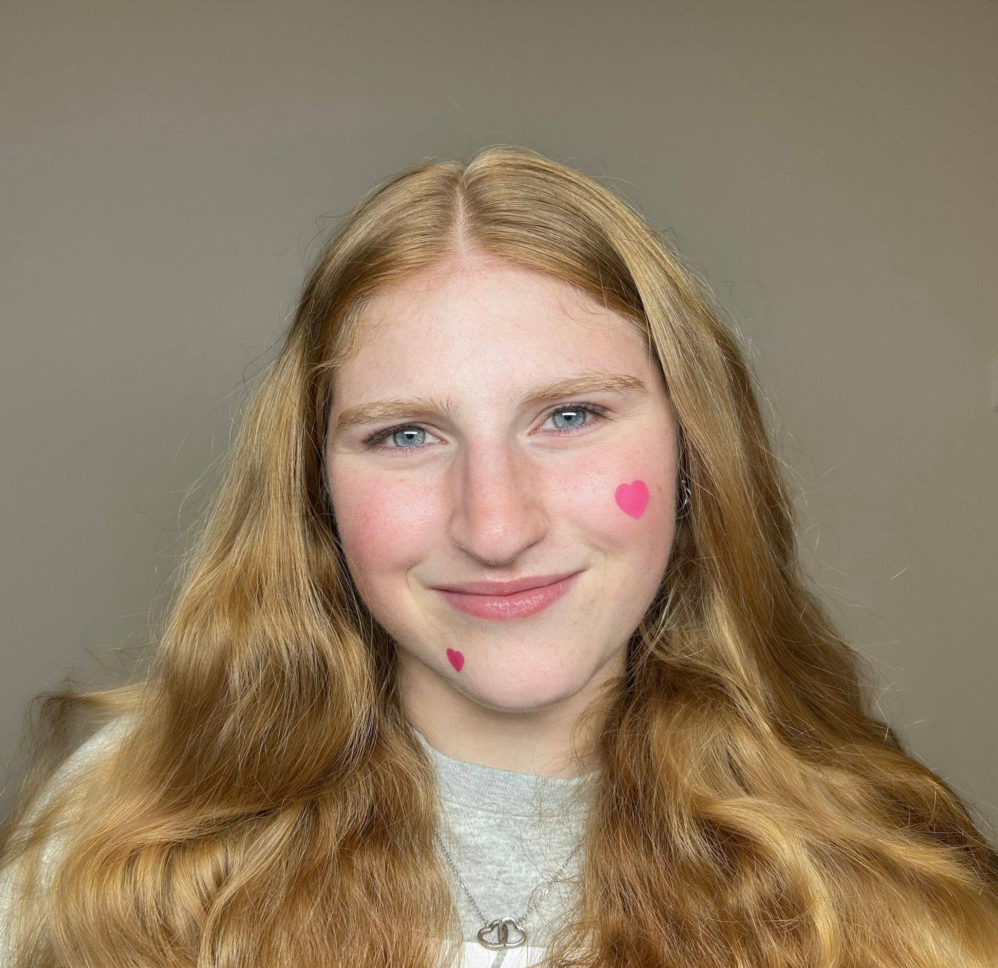 PatchAid - Wholesale Acne/Hydrocolloid Patch - Pimple Patch Hearts – Fun & Chic Fix for Blemish-Free Skin5