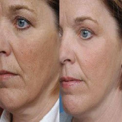 JMB Products Inc. / NeedCrystals – wholesale Ansiktsexfoliant/Scrub – Microdermabrasion Kristaller Face Scrub med vitamin C.3