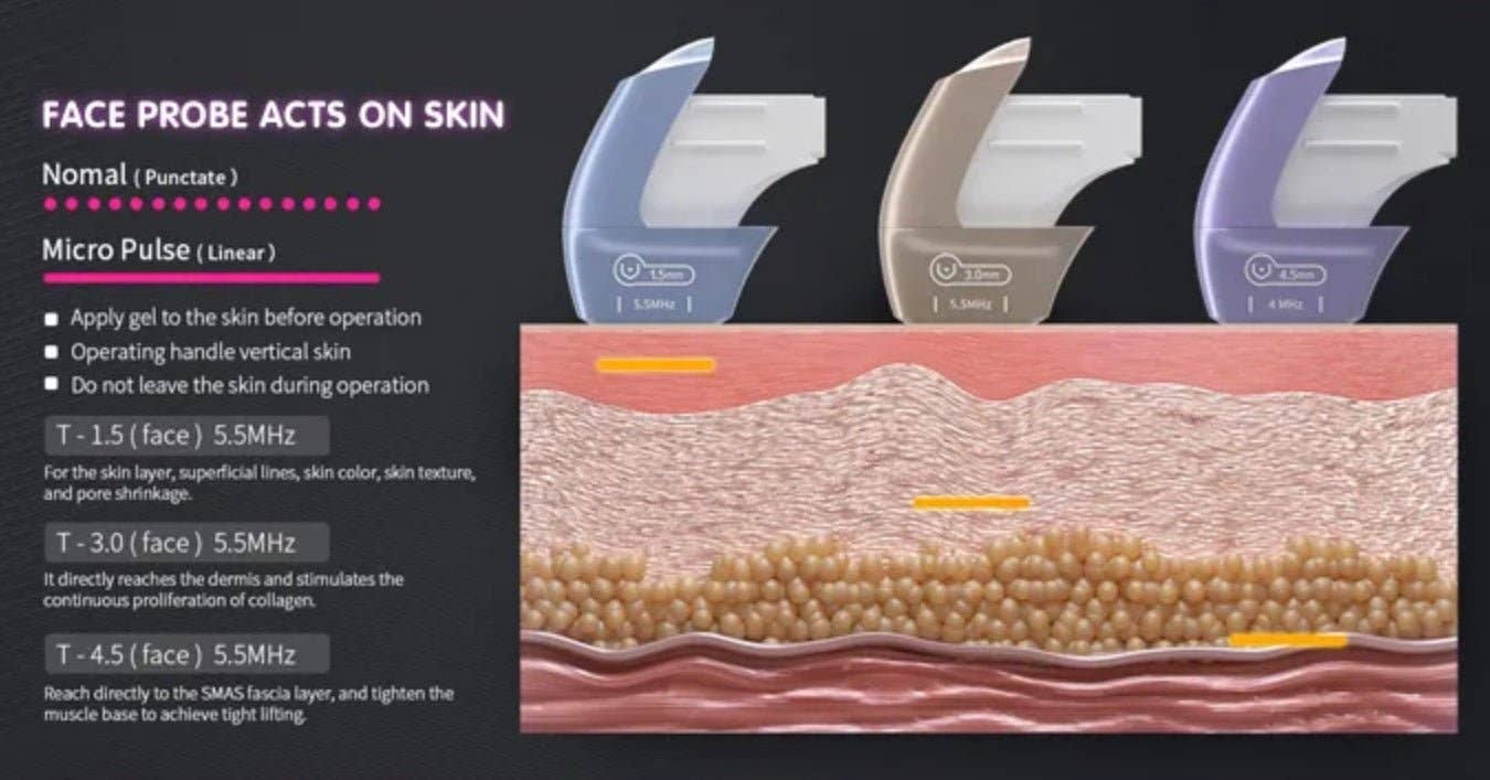 Cavitation Machines - Wholesale Electronic Skincare Device - Shape Tactics Advanced 3-Handle Dual Control 12D HIFU System17