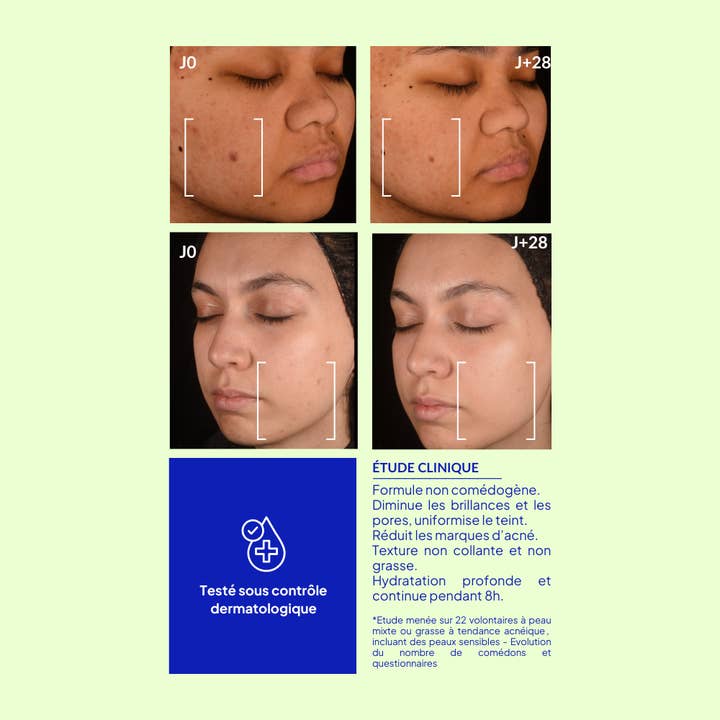 3B PHARMA - Wholesale Facial Moisturizer - Purifying Facial Care Azelaic Acid - Customizable4