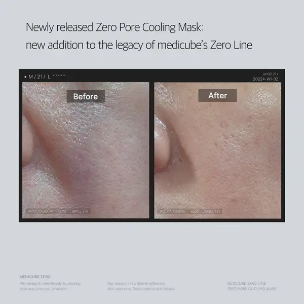 Sol Beauty Lab - Wholesale Skincare Face Mask - BULK - Medicube Zero Pore Cooling Mask3