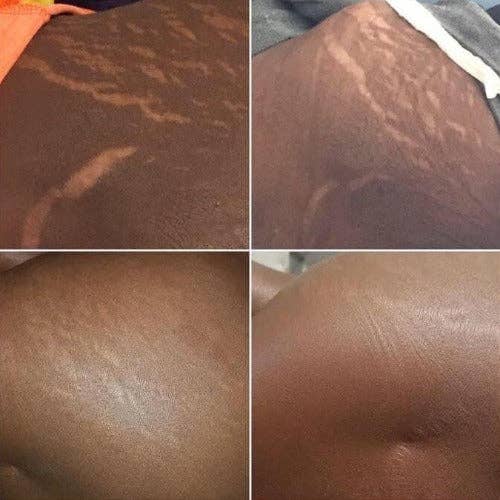 WHOLIFECO - Wholesale Body Balm/Butter - Unrefined Organic Shea butter from Africa