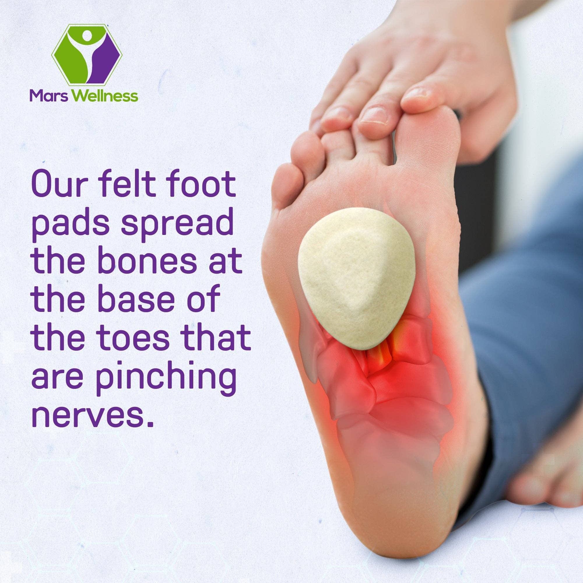 Mars Wellness – wholesale Foot cream – Premium Comfort Metatarsal Felt Foot Neuroma Pads3