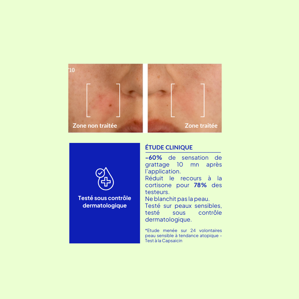 3B PHARMA - Vendita all'ingrosso Pomata/crema antiprurito - Pomata lenitiva anti-graffio con ceramidi - personalizzabile4