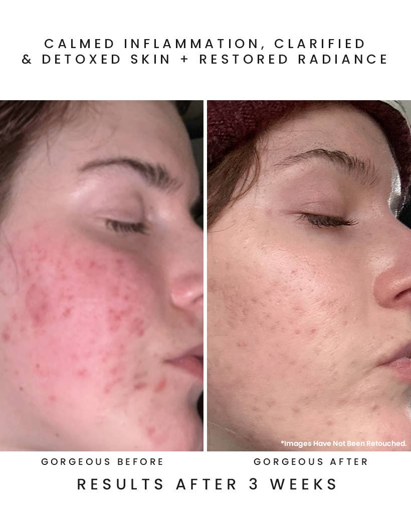 Earth Harbor Naturals - Wholesale Facial Serum/Concentrate - OBSCURA Night Repair Concentrate: Black Seaweed + Bakuchiol5