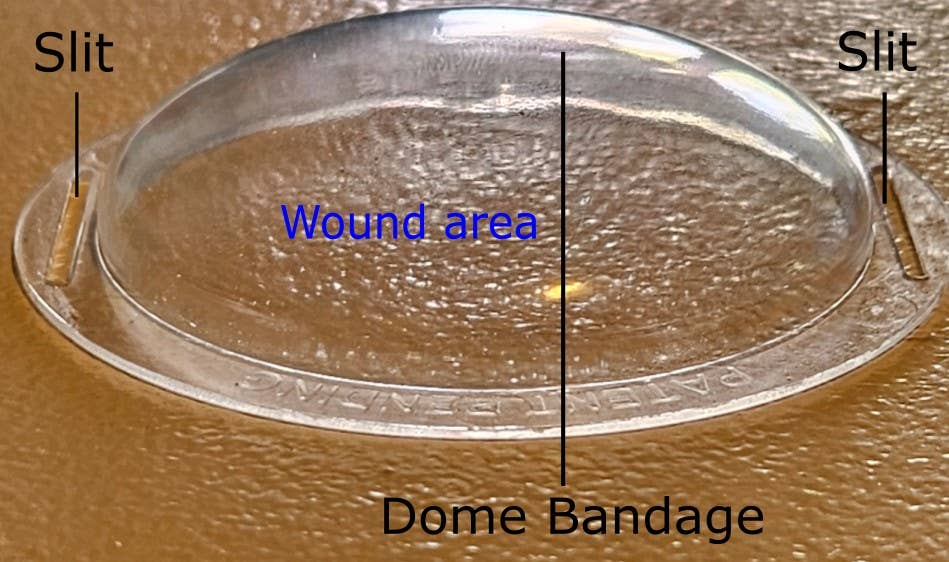 Nursphere Original Dome Bandages - Wholesale Bandaids/Bandages - Nursphere® Original Clear Dome Bandages™/Wound Tracker™ App2