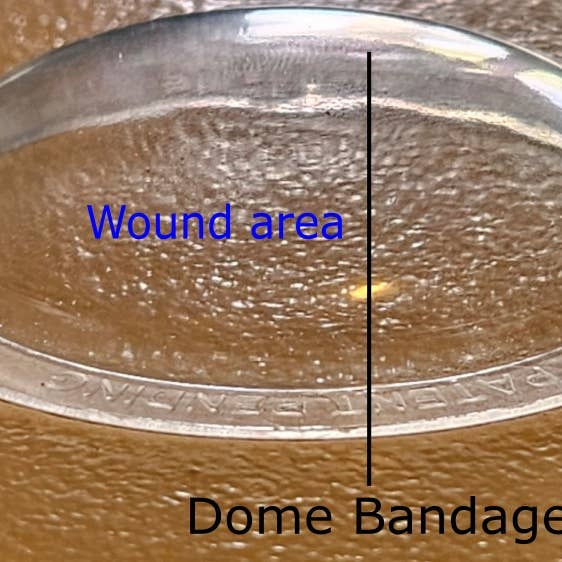 Nursphere Original Dome Bandages - Wholesale Bandaids/Bandages - Nursphere® Original Clear Dome Bandages™/Wound Tracker™ App2